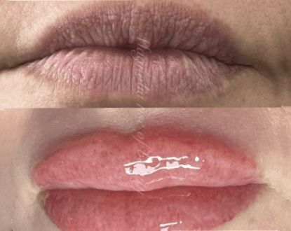 LIP BLUSH